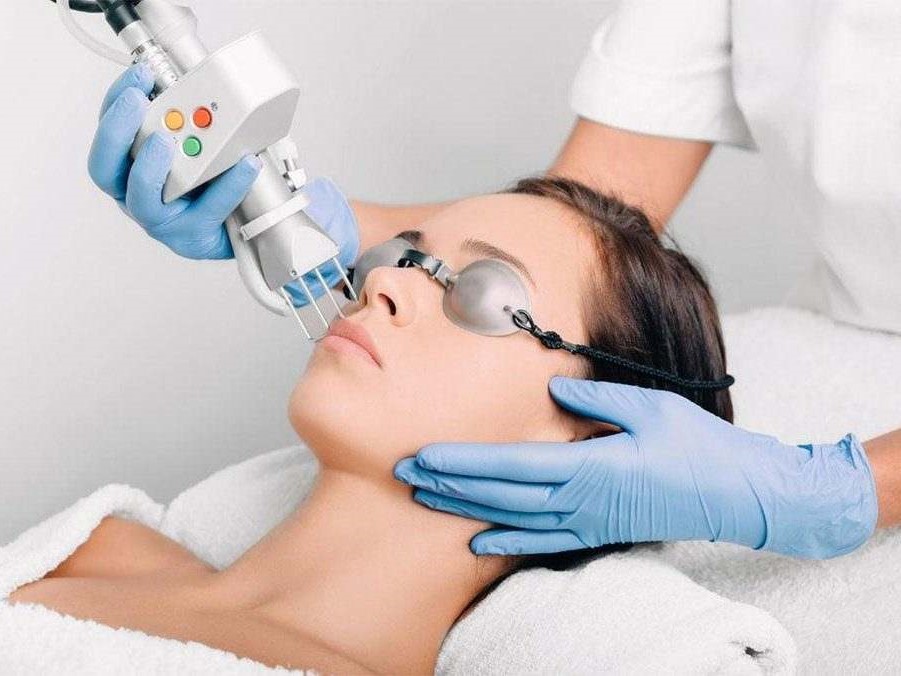 Tratament laser fracționar-ablativ CO2